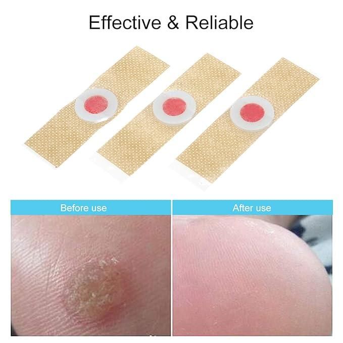 Corn Remover Pads Pack of 12